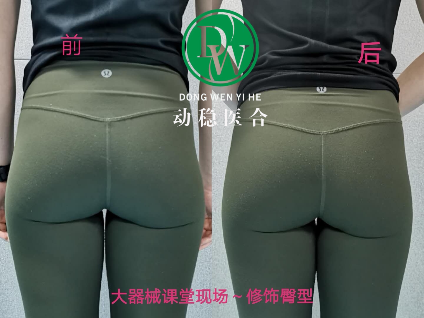 学员案例对比图