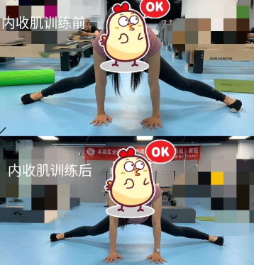 学员案例对比图