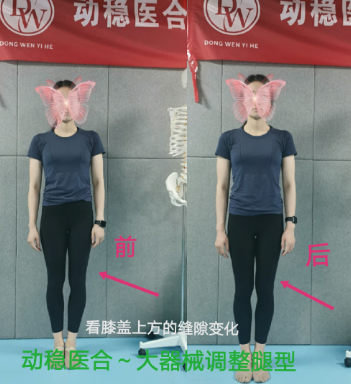 学员案例对比图