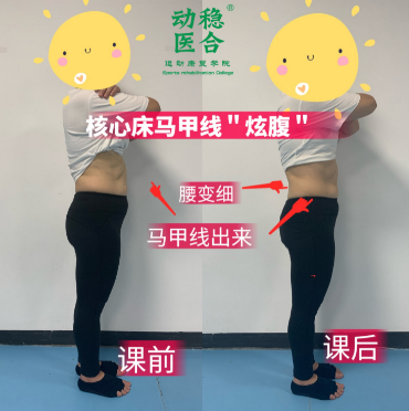 学员案例对比图