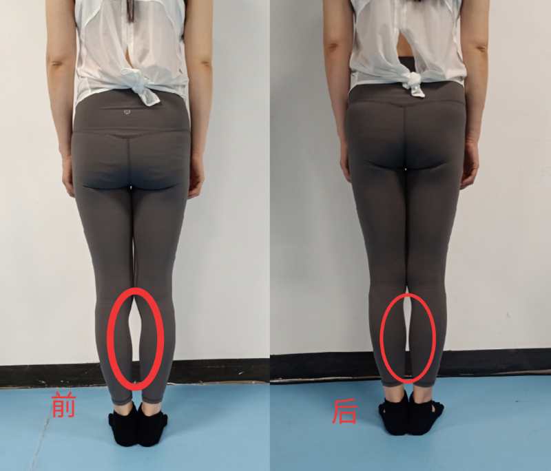学员案例对比图